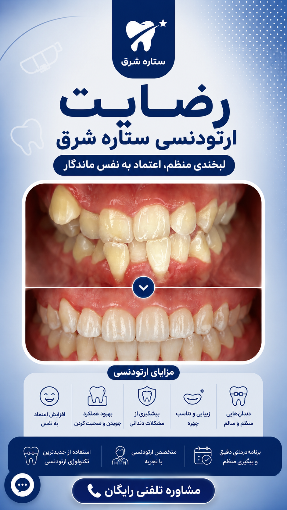 رضایت درمان ریشه